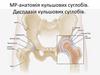 МР-анатомія кульшових суглобів. Дисплазія кульшових суглобів