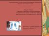 Абсцесс легкого. Сравнение времен действительного и страдательного залогов