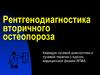 Рентгенодиагностика вторичного остеопороза