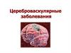 Цереброваскулярные заболевания