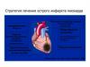 Стратегия лечения острого инфаркта миокарда