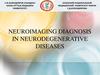 Neuroimaging diagnosis in neurodegenerative diseases