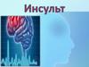 Инсульт