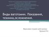 Виды ваготомии. Показания, техника, осложнения