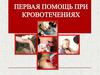 Первая помощь при кровотечениях