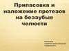 Припасовка и наложение протезов на беззубую челюсть