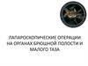 Лапароскопические операции на органах брюшной полости и малого таза