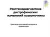 Рентгенодиагностика дистрофических изменений позвоночника
