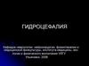 Гидроцефалия