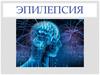 Эпилепсия