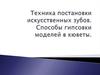 Техника постановки искусственных зубов. Способы гипсовки моделей в кюветы