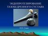 Эндопротезирование тазобедренного сустава