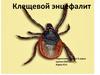 Клещевой энцефалит