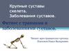 Крупные суставы скелета. Заболевания суставов. Фитнес с травмами и заболеваниями суставов
