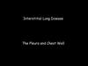Interstitial Lung Disease