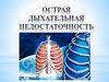 Острая дыхательная недостаточность