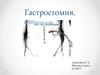 Гастростомия