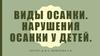 Виды осанки. Нарушения осанки у детей