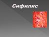 Сифилис. Исторические аспекты