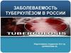 Заболеваемость туберкулёзом в России