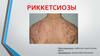 Риккетсиозы