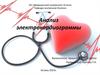 Анализ электрокардиограммы