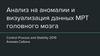 Анализ на аномалии и визуализация данных. МРТ головного мозга