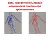 Виды кровотечений, первая медицинская помощь при кровотечениях