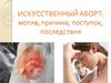 Искусственный аборт. Мотив, причина, поступок, последствия