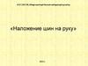 Наложение шин на руку