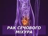 Рак сечового міхура