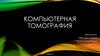 Компьютерная томография