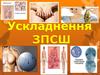 Ускладнення ЗПСШ