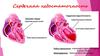 Сердечная недостаточность