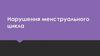 Нарушения менструального цикла