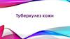 Туберкулез кожи. Виды