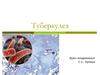 Туберкулез