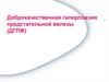 Доброкачественная гиперплазия предстательной железы (ДГПЖ)
