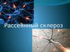 Рассеянный склероз