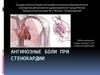Ангинозные боли при стенокардии
