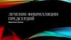 Лечение фибрилляции предсердий