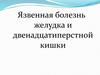 Язвенная болезнь желудка и двенадцатиперстной кишки