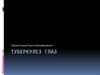 Туберкулез глаз
