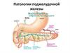 Патологии поджелудочной железы
