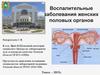 Воспалительные заболевания женских половых органов