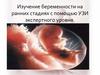 Ранние сроки беременности. УЗИ экспертного уровня