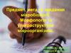 Предмет, мета та завдання мікробіології. Морфологія та ультраструктура мікроорганізмів