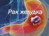 Рак желудка