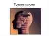 Травма головы