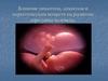 Влияние никотина, алкоголя и наркотических веществ на развитие зародыша человека